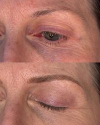 Nano Combo Brows