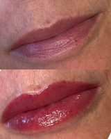Before & After of Actual Client with Lip Blush.