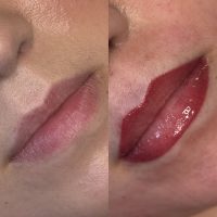Lip Blush procedure photo, before & after, healed, and natural-looking results with a soft, tinted-lip effect.
